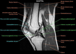 knee-cruciate-ligament_imagelarge